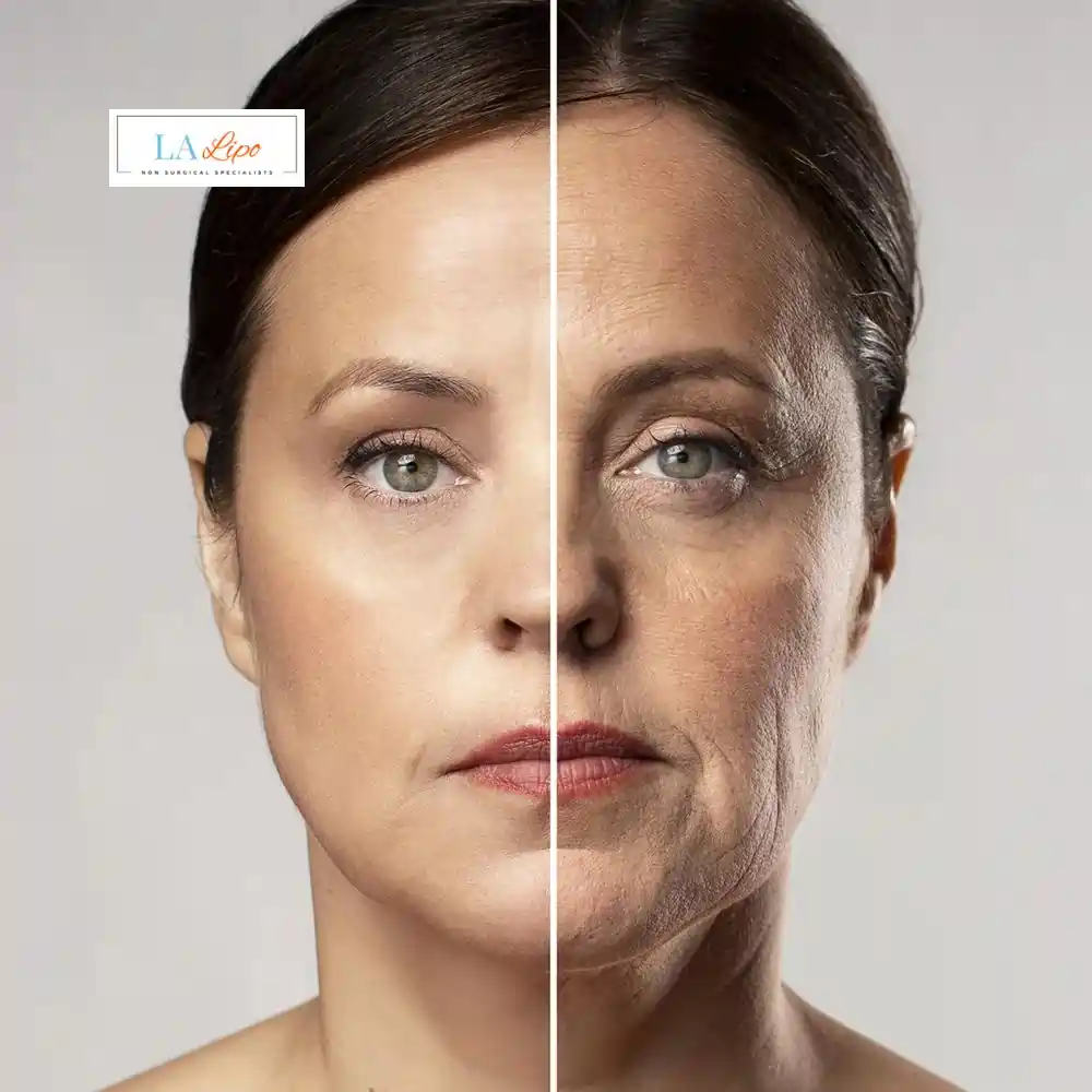 How Can You Tell If Non-Surgical Skin Tightening Is Right for You Ossett?