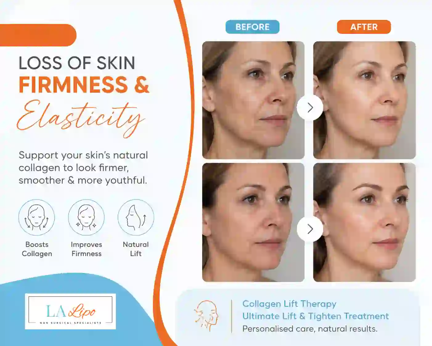Sign #7: Loss of Skin Firmness and Elasticity Ossett